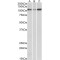 Sarcoplasmic/Endoplasmic Reticulum Calcium ATPase 2 (ATP2A2) Antibody