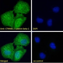 Catenin Beta 1 (CTNNB1) Antibody