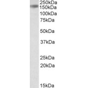 abx430644 (0.3 µg/ml) staining of Human Liver lysate (35 µg protein in RIPA buffer). Primary incubation was 1 hour. Detected by chemiluminescence.