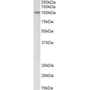 abx430651 (2 µg/ml) staining of nuclear Jurkat lysate (35 µg protein in RIPA buffer). Primary incubation was 1 hour. Detected by chemiluminescence.