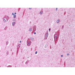 Phosphatidylinositol-4,5-Bisphosphate 3-Kinase Catalytic Subunit Alpha Isoform (PIK3CA) Antibody