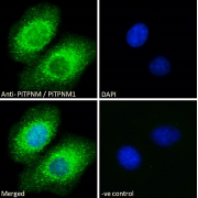 Immunofluorescence analysis of paraformaldehyde fixed A549 cells, permeabilized with 0.15% Triton. Primary incubation 1hr (10 µg/ml) followed by Alexa Fluor 488 secondary antibody (2 µg/ml), showing cytoplasmic and Endoplasmic Reticulum staining. The nuclear stain is DAPI (blue). Negative control: Unimmunized goat IgG (10 µg/ml) followed by Alexa Fluor 488 secondary antibody (2 µg/ml).