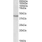 POU Class 3 Homeobox 2 (POU3F2) Antibody