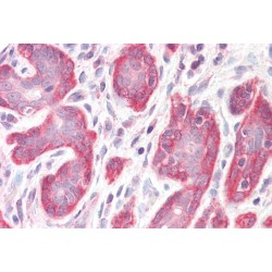 PDZ And LIM Domain 4 (PDLIM4) Antibody