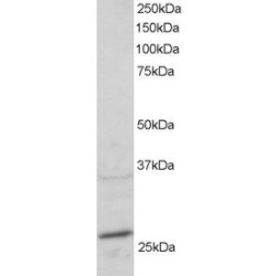 Ras-Related Protein Rab-11A (RAB11A) Antibody