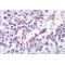 Dual Specificity Phosphatase 14 (DUSP14) Antibody