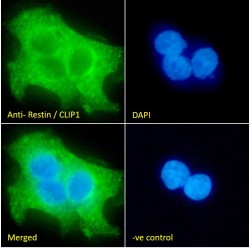 Restin Antibody