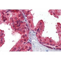 Restin Antibody