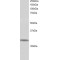 Zinc Finger Protein 230 (ZNF230) Antibody