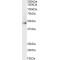 ADRB2R Antibody