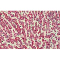 Anthrax Toxin Receptor 2 (ANTXR2) Antibody
