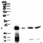 abx430703 (2 µg/ml) staining of secretions from Human primary airway cells in culture (lanes 1 and 2), and in Human Bronchoalveolar Lavage fluid (lanes 3 and 4) . Data obtained from Dr. C Bingle, AURM, University of Sheffield, UK. Primary incubation was 1 hour. Detected by chemiluminescence.