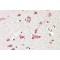 Golgin Subfamily A Member 6 (GOLGA6) Antibody