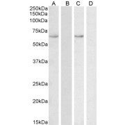 abx430723 (0.1 µg/ml) staining of Human Uterus lysate (A) + peptide (B) and (0.3 µg/ml) Colon lysate (C) + peptide (D) (35 µg protein in RIPA buffer). Detected by chemiluminescence.