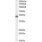 Potassium Voltage-Gated Channel Subfamily J Member 11 (KCNJ11) Antibody