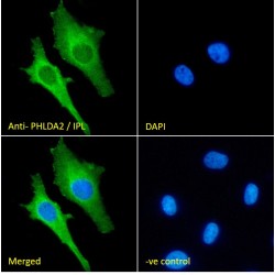IPL Antibody