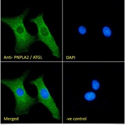 Adipose Triglyceride Lipase (ATGL) Antibody