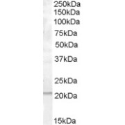 abx430742 (1 µg/ml) staining of A549 lysate (35 µg protein in RIPA buffer). Primary incubation was 1 hour. Detected by chemiluminescence.