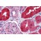 Ring Finger Protein 213 (RNF213) Antibody