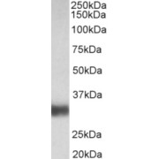 abx430753 (0.01 µg/ml) staining of Human Lung lysate (35 µg protein in RIPA buffer). Primary incubation was 1 hour. Detected by chemiluminescence.