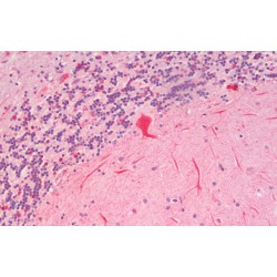 Solute Carrier Family 7 Member 6 (SLC7A6) Antibody
