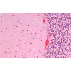 Solute Carrier Family 7 Member 6 (SLC7A6) Antibody
