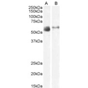 abx430761 (2 µg/ml) staining of Human Lung (A) and Skeletal Muscle (B) lysate (35 µg protein in RIPA buffer). Primary incubation was 1 hour. Detected by chemiluminescence