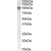 abx430765 (0.3 µg/ml) staining of Human Pancreas lysate (35 µg protein in RIPA buffer). Detected by chemiluminescence.