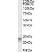 abx430767 (0.01 µg/ml) staining of Human Colon lysate (35 µg protein in RIPA buffer). Primary incubation was 1 hour. Detected by chemiluminescence.