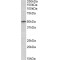 Tripartite Motif Containing 35 (TRIM35) Antibody