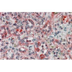 Thioredoxin Domain-Containing Protein 1 (TXNDC1) Antibody