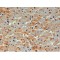 E2-230K Antibody