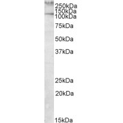 abx430783 (1 µg/ml) staining of Human Peripheral Mononucleocytes lysate (35 µg protein in RIPA buffer). Primary incubation was 1 hour. Detected by chemiluminescence.