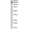 ATP/GTP Binding Protein 1 (AGTPBP1) Antibody