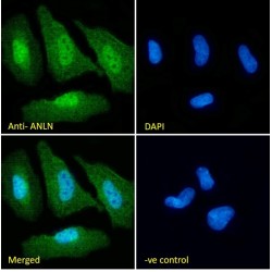 ANILLIN (ANLN) Antibody