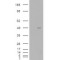 Amyotrophic Lateral Sclerosis 2 Chromosomal Region Candidate Gene 2 Protein (ALS2CR2) Antibody