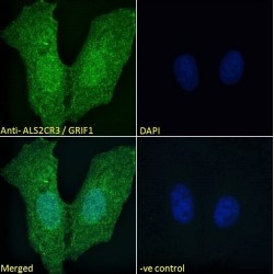 Amyotrophic Lateral Sclerosis 2 Chromosomal Region Candidate Gene 3 Protein (ALS2CR3) Antibody