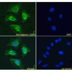 Asporin (ASPN) Antibody