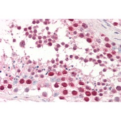 dUTPase Antibody