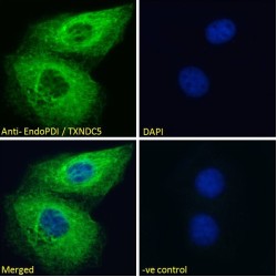 EndoPDI Antibody