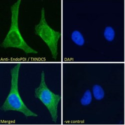 EndoPDI Antibody