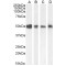 EndoPDI Antibody