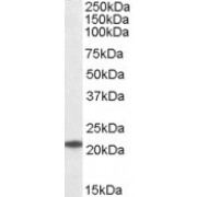 abx430804 (0.1 µg/ml) staining of K562 lysate (35 µg protein in RIPA buffer). Primary incubation was 1 hour. Detected by chemiluminescence.