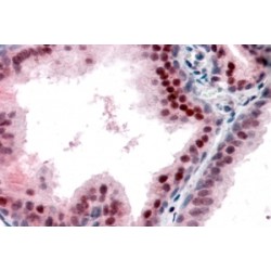 P27KIP1 Antibody