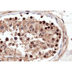 Rac-GTPase Activating Protein 1 (RACGAP1) Antibody