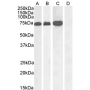abx430811 (1 µg/ml) staining of A431 nuclear (A), Jurkat (B), Jurkat nuclear (C) and negative control Human Pancreas (D) lysate. (35 µg protein in RIPA buffer) Detected by chemiluminescence.