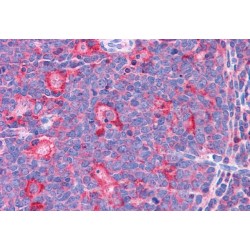 Tumor Protein D54 (TPD52L2) Antibody
