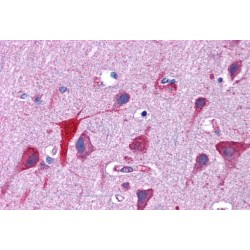 Tumor Protein D54 (TPD52L2) Antibody