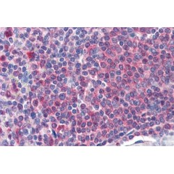 Catalase (CAT) Antibody