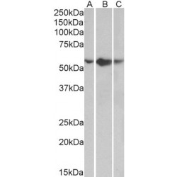 Tumor Necrosis Factor Receptor Superfamily Member 1A / CD120a (TNFRSF1A) Antibody